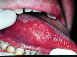 microorganismos zonadental6