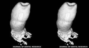 JOURNAL OF DENTAL RESEARCH