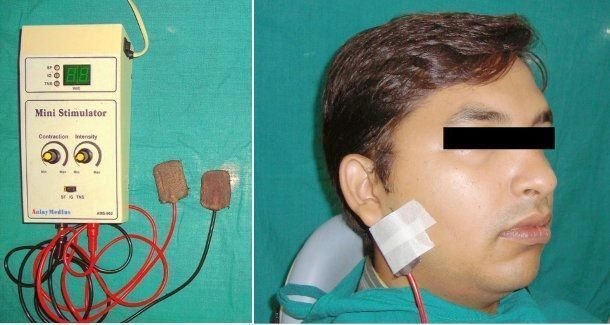 (Fotos cortesía de Aggarwal, Hersheal et al., Journal of Clinical and Experimental Dentistry).