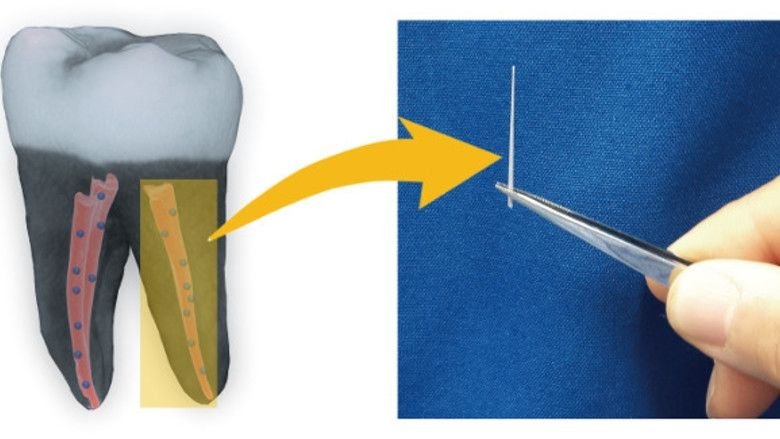 (Imagen: UCLA School of Dentistry)