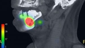 (Imagen: Prof. Remco de Bree, VU University Medical Center Amsterdam)